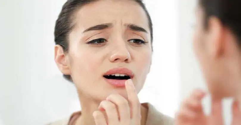 Chapped Lips – Causes, Treatments, and Prevention