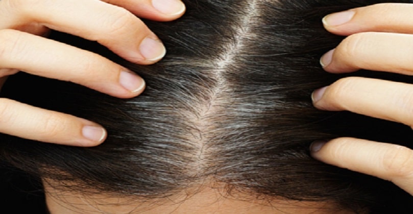 Hair fall Treatment: Home Remedies on How to Stop Hair Fall