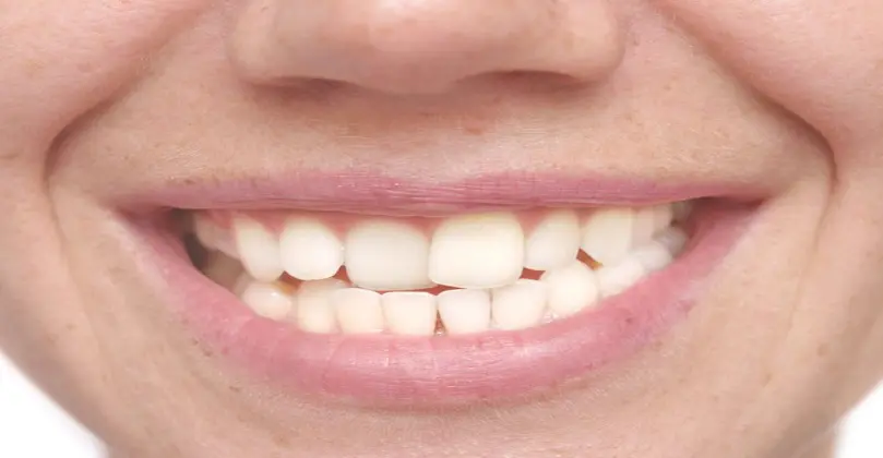 Oral Health Basics: Symptoms, Types, Causes & More